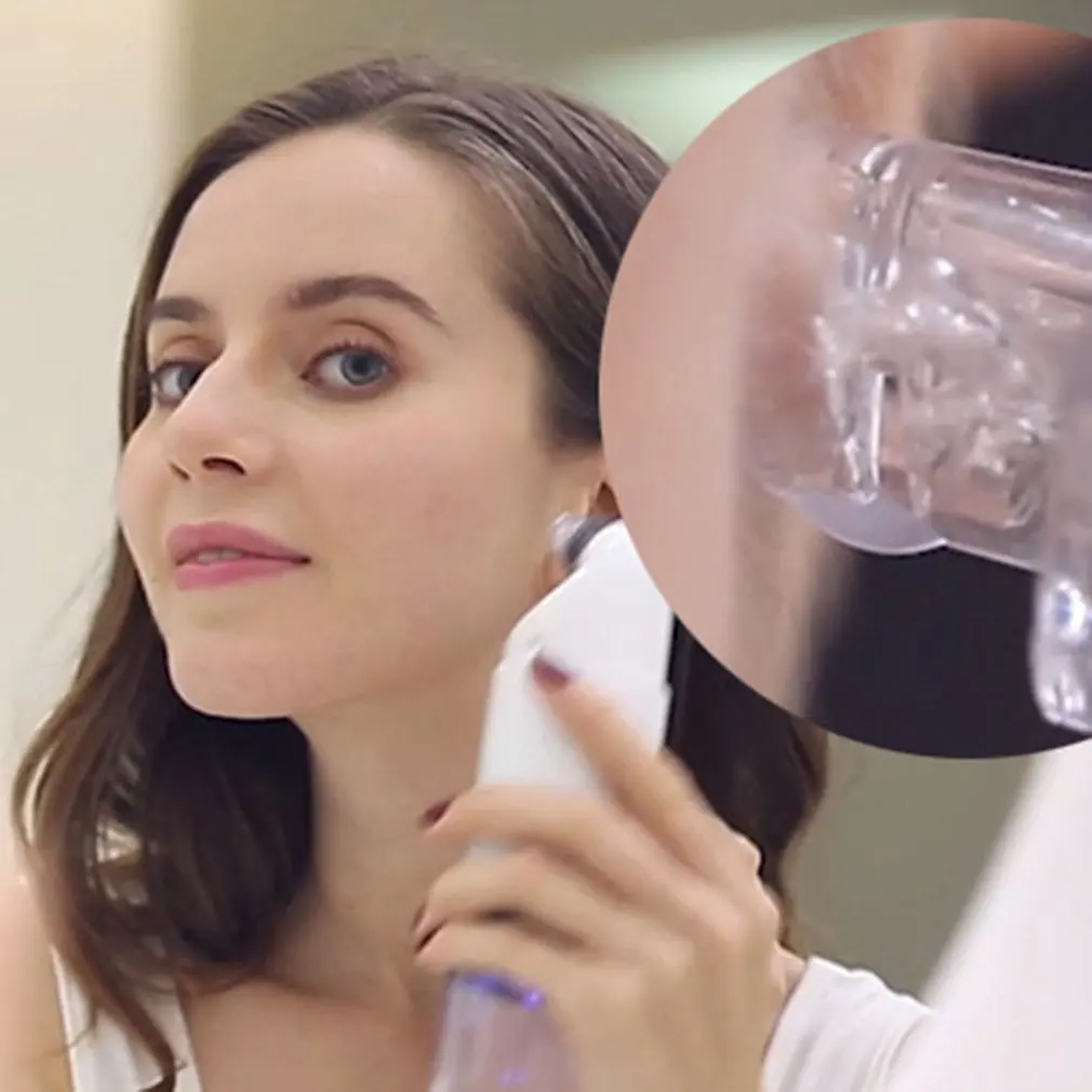 Артефакт Blackhead инструмент для удаления черных точек электрическое всасывание акне Бытовая кисточка для чистки пор маленький пузырь инструмент красоты