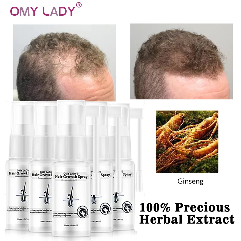 Liquid Hair-Care-Products Essential-Oil Dry-Hair Anti-Hair-Loss Omy Lady Spray Regeneration