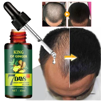 

30ml 7 Day Ginger Germinal Oil Serum Essence Oil Natural Essence Effective Fast Growth Hair Care Natural Hair Loss Treatement