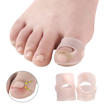

2Pcs Nail Orthodontic Device Silicone Nail File Light Skin Toes Finger Nails Pedicure Tool Nail Art DIY Design Accessories