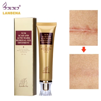 

LANBENA 30ml Acne Scar Removal Cream Skin Repair Face Cream Acne Spots Acne Treatment Blackhead Whitening Cream Stretch Marks