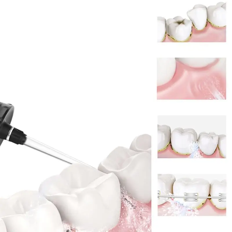 Adult Teeth Cleaner Oral Irrigators Electric Portable Irrigator Water Flosser 3