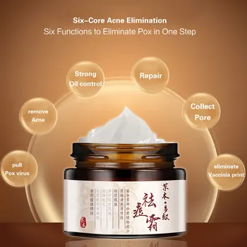 

Natural Herbal Blackhead Removal Cream Anti Pimple Spot Acne Scars Cream Lasting Whitening Creams Nourishing