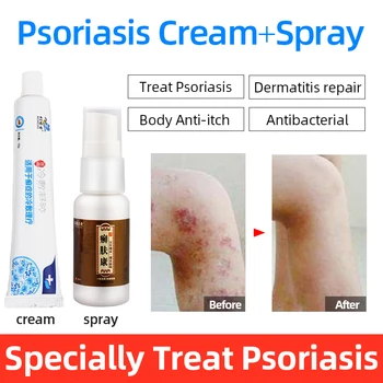 

Medical Herbal Cold Compress Psoriasis Ointment Repair Body Eczema Psoriasis Antibacterial Skin Dermatitis Itching Cream