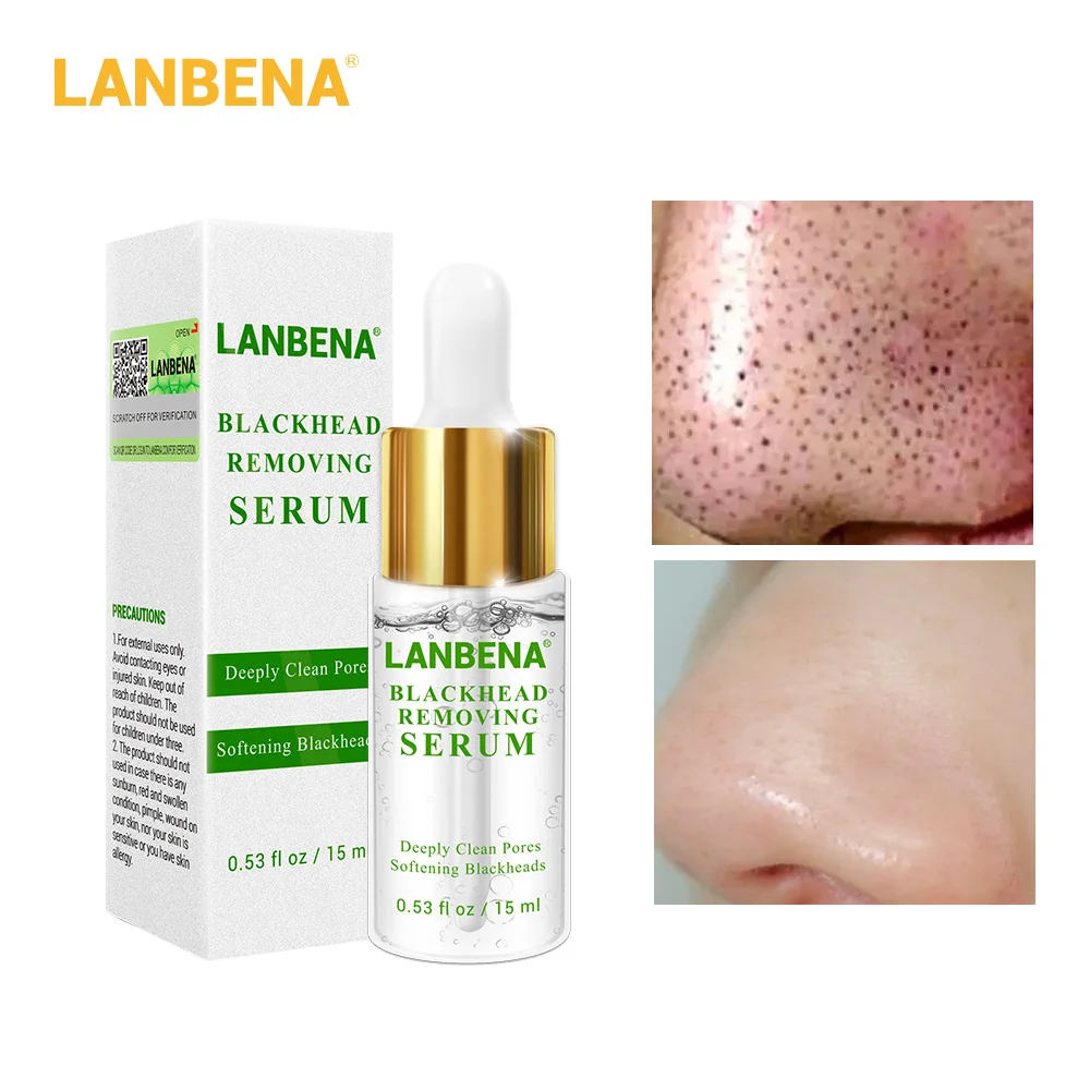 Сыворотка LANBENA для глубокого удаления черных точек акне мягкое удаление средство