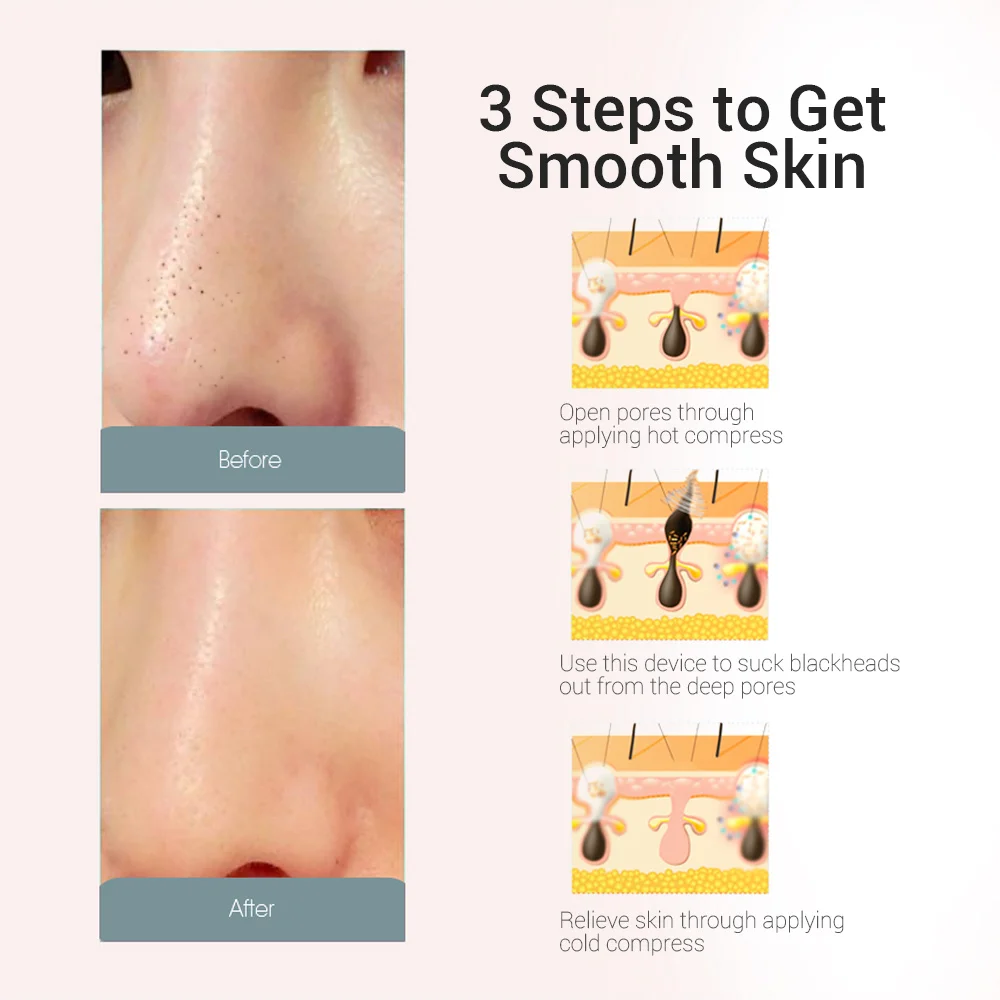 New Electric Blackhead Remover With 3 Replaceable Probes Skin Face Deep Care Pore Cleaner Acne Pimple Removal Care Tool