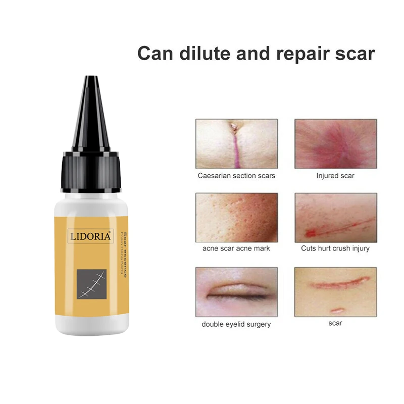 1pc 20ml Herbal Scar Mark Removal Skin Whole Body Care Cream Blemish Treatment Skin Scar Smoothing Repair Fluid Skincare TSLM1