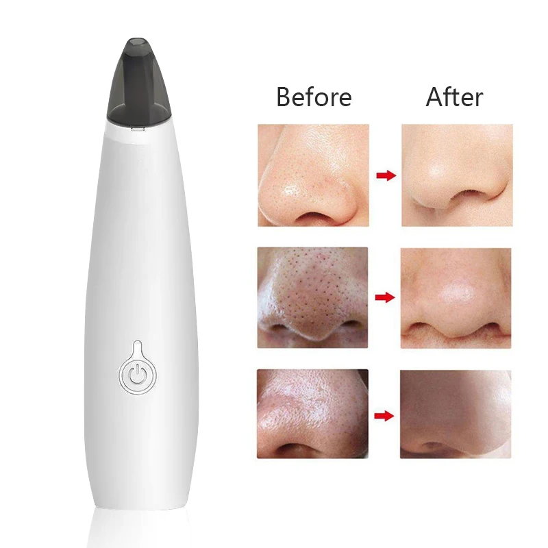 

Manufacturer direct-selling electric blackhead cleaner electric blackhead cleaner facial acne instrument Pore Cleaner