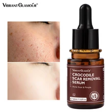 VIBRANT GLAMOUR Crocodile Scar Repair Serum Acne Treatment Stretch Marks Removal Acne Scar Whitening For Spots Skin Care 30ml