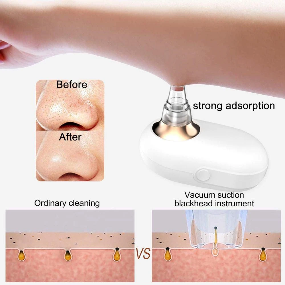 Электрический вакуумный очиститель пор от угрей дятел угрей прыщей инструмент для чистки красоты уход за кожей лица Глубокая чистка