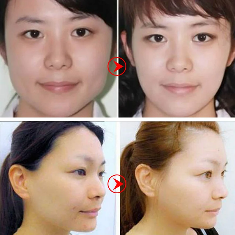 1 Pcs V-Shaped Slimming Face Mask Moisturizing Whitening Face Firming Mask YUF99