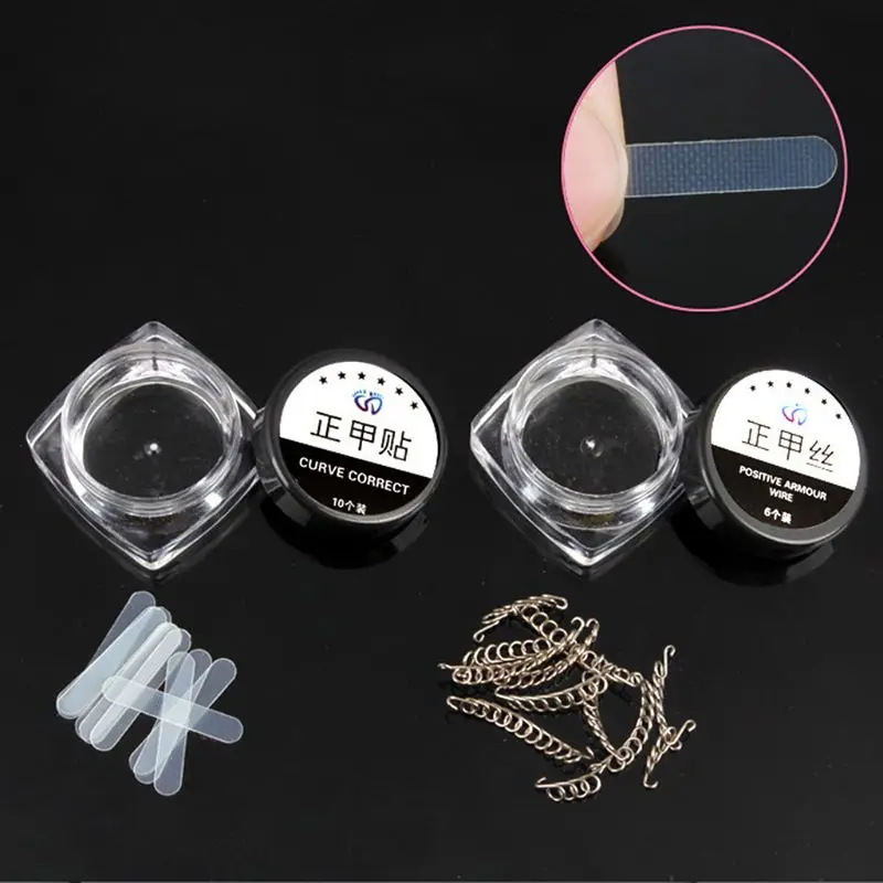 Вросшие ногти для ног &quotфранцзуский маникюр&quot коррекции фиксаж провода щипчики