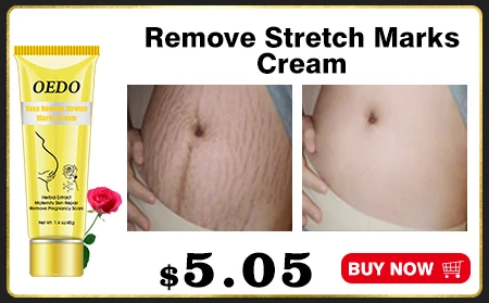 Buy 3 Get 1 Gift Hand Cream Rose Polypeptide Moist Repair Nourishing Whitening Anti Chapping-Wrinkle Improve Drying Skin Care