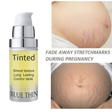 Редуктор растяжки, Осветляющий пигмент для Удаления растяжек, Эфирный крем для ухода за кожей, высокоэффективный