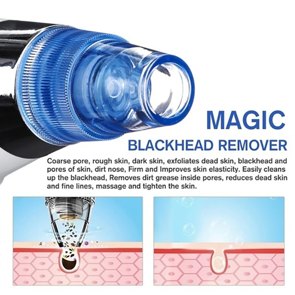 H8ae14c19487c45dfbc921d3fbf477ea30 Beauty-Health Blackhead Remover Vaccum Suction Facial Cleaner