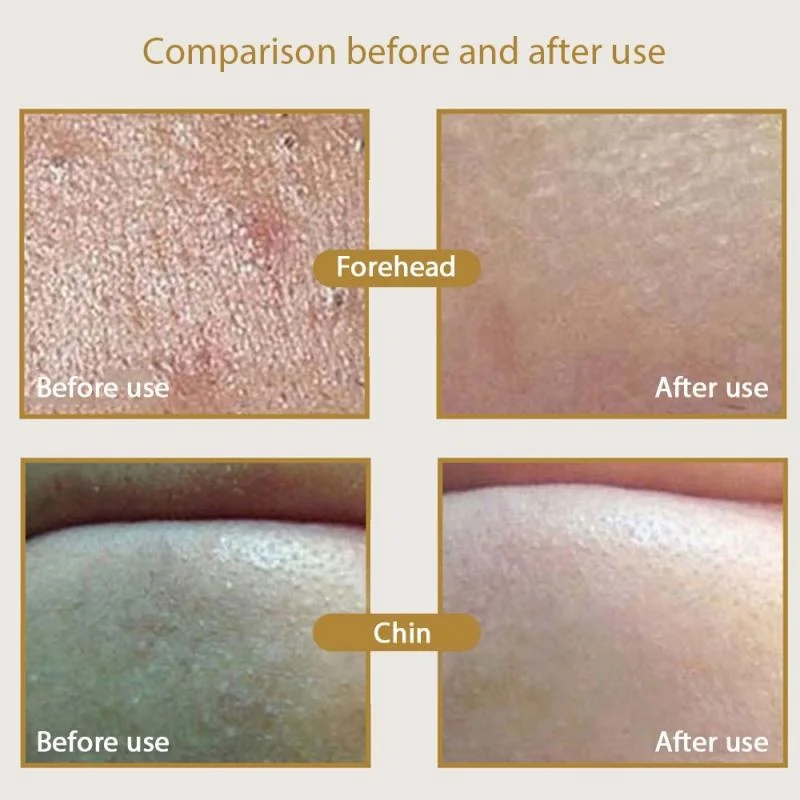 H9001efa90705437c8d94aff3be036a4aD