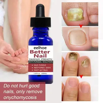 

LANBENA Nail Repair Essence Nail Fungus Removal Anti Onychomycosis Feet Care Treatment With Foot File Nail Repair Liquid