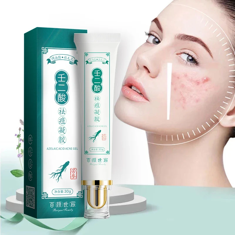 Effective Acne Removal Cream Treatment Fade Spots Oil Control Shrink Pores Whitening Moisturizing Skin Care | Красота и здоровье