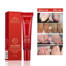 Питание ногтей масло грибковое Лечение ногтей эссенция удаление грибка ног Onychomycosis Paronychia Предотвращение Agnail гель для ухода за ногами