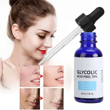 

Glycolic Acid Serum Moisturizing Fine Line Freckle Removal Nourishing Repair Solution 30ml Anti-Wrinkle Serum