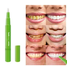 Горячая Распродажа отбеливающая ручка для зубов эффективная безболезненная без чувствительности красивая белая улыбка Новое поступление высокое качество J3