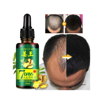 

30ml Hair Growth Oil Unisex Thinning Hair Stimulating Conditioner Supplement Anti Hair Loss Hair Growth Vitamins Care Oils