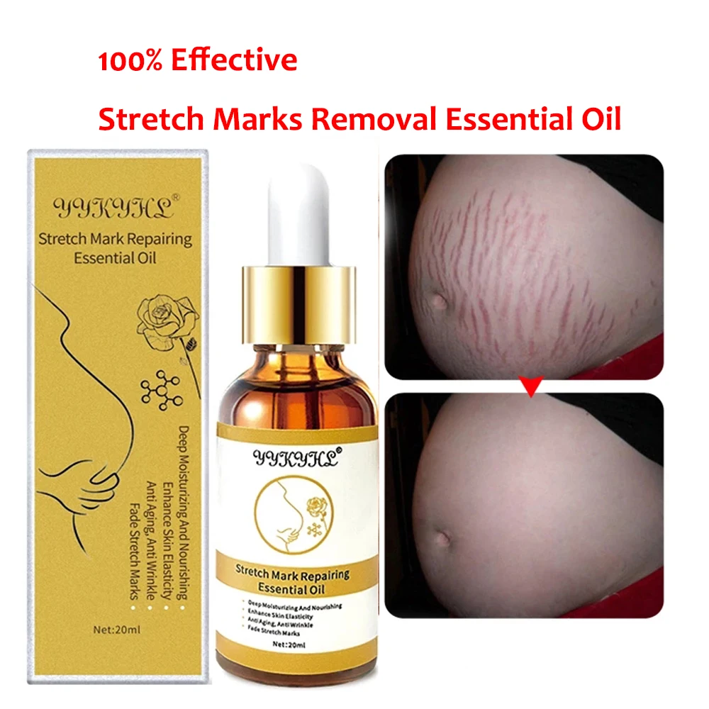 Stretch Marks Removal Essential Oils Pure Natural Stretch Marks Remover