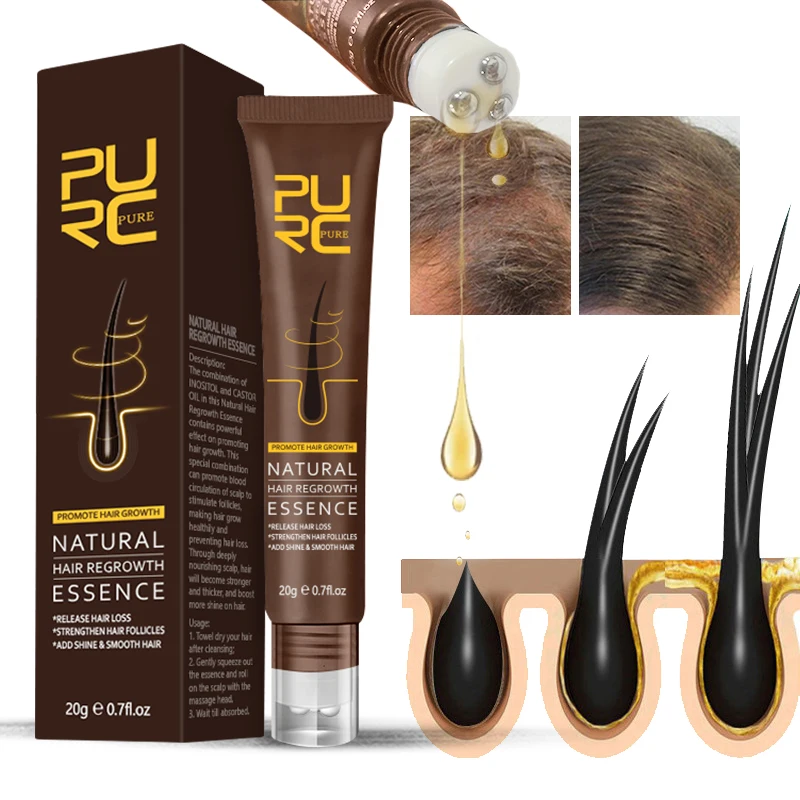 Purc Fast Hair Growth Oil Prevent Hair Loss Treatment Ginger Extract