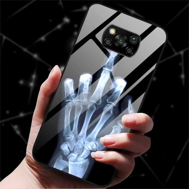 Glass Case For Xiaomi Poco X3 Pro Phone Case Cover Tempered Glass Back  Cover Case For