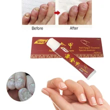 Лечение грибка ногтей онихомикоз паронихии анти-грибковая инфекция ногтя хороший результат Китайский травяной платырь против носок Уход за ногтями