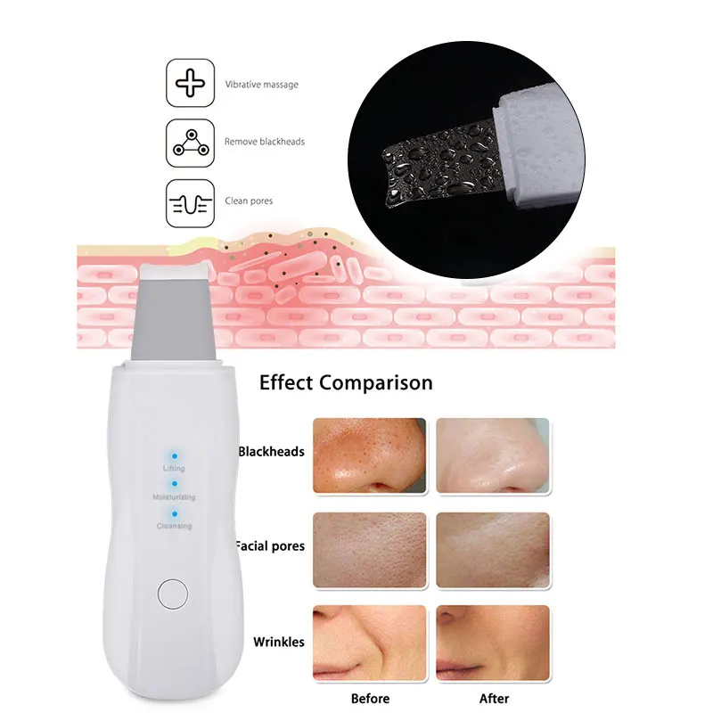 Purificador da Pele Cuidados com a Pele Estilo Ultra-sônico Limpador Cravo Remoção Rosto Purificador Beleza Aparelhos Abs Branco Remover Limpa 7 14 branco remover cuidados com a pele limpa