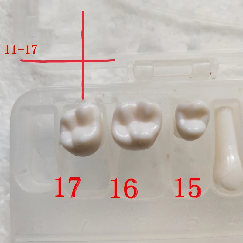 28 шт. высококачественное моделирование зуба зерна смолы моделирование зуба зерна Стоматологическая модель зуба для дантиста подготовки к тесту обучения