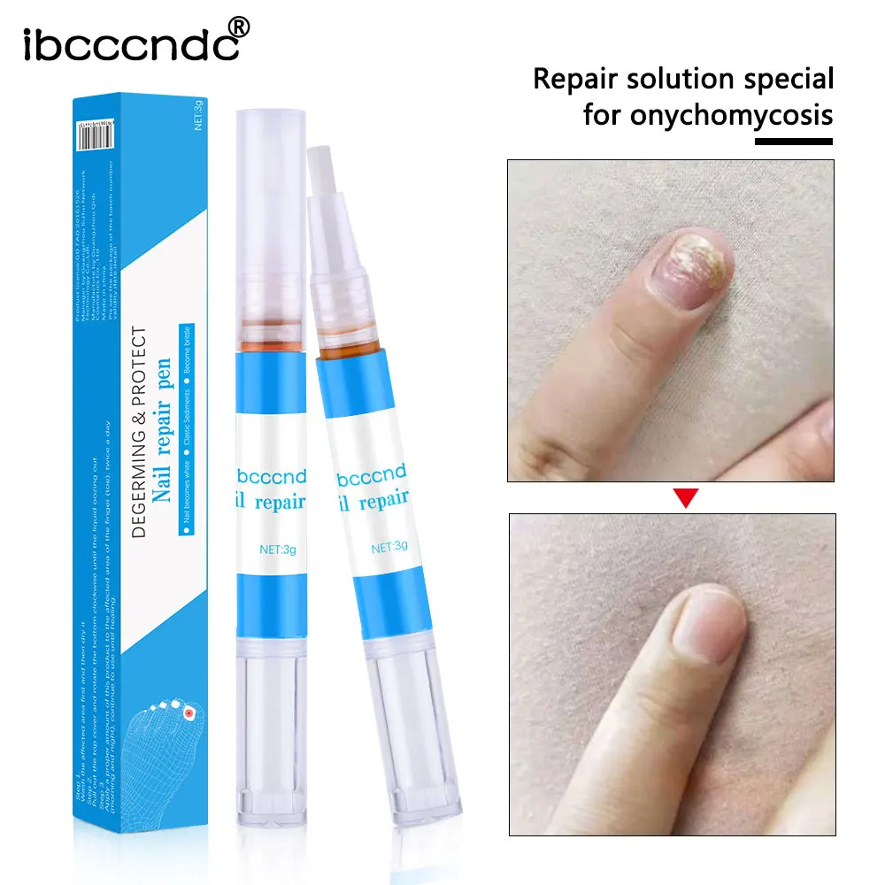 1 шт для ремонта ногтей жидкая ручка грибковая ручка для ногтей эффективная onychomicosis Paronychia грибок инфекция ремонт раствор гель для пальца