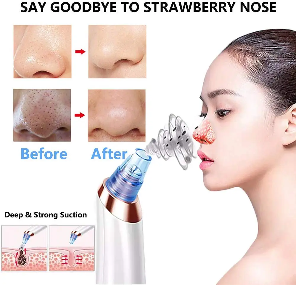 Blackhead Vacuum Remover Cleaner Pore Suction Electric Pimple Extractor Acne Removal Tool Professional Facial Care Tools 5