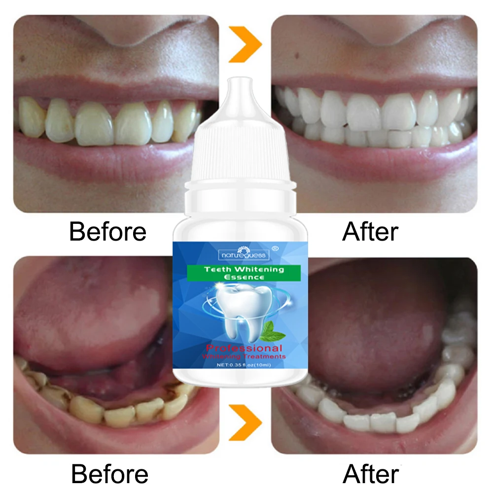 Teeth Whitening Powder Teeth Whitening Strips Teeth Whitening Essence Powder Clean Oral Hygiene Whiten Teeth Remove Plaque Stains Fresh Breath Oral Hygiene Dental Tools