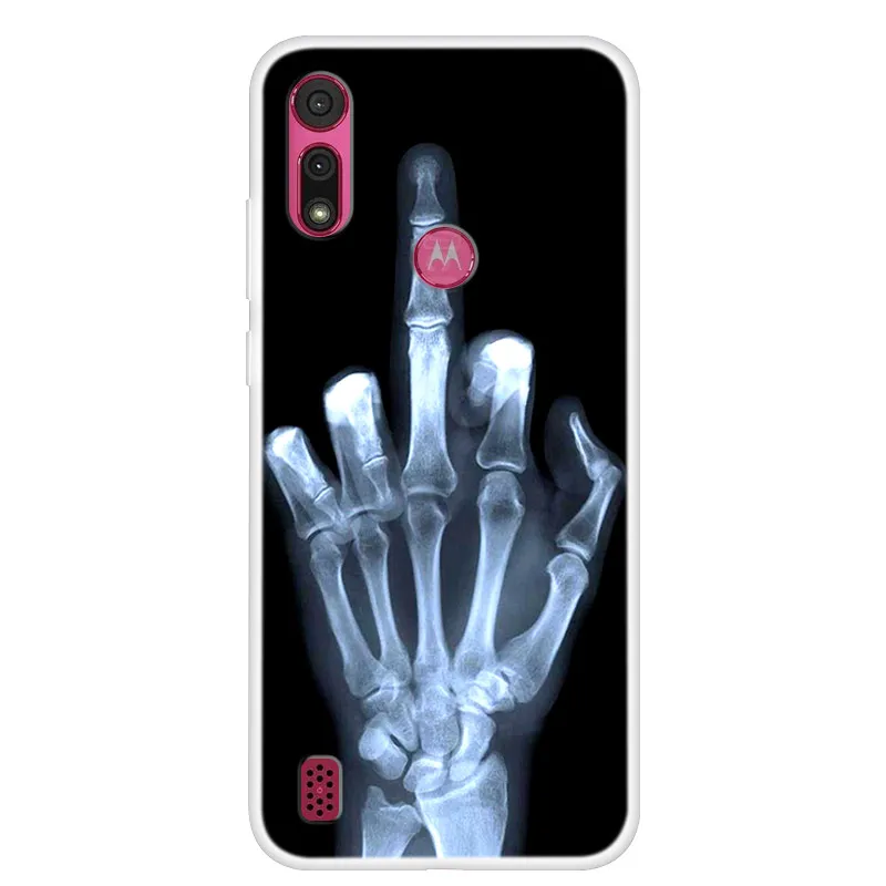 PekaTech Custodia con Collana per Motorola Moto E6S, Cover Trasparente Morbido Silicone con Cordino Case con Laccio Tracolla [Antiurto] [ AntiGraffio] [Antiscivolo] TPU Cover con Collana, Rosa