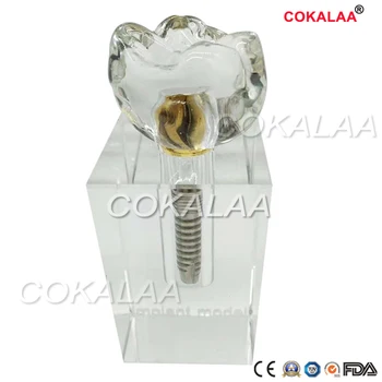 

Dental Crystal planting model explanation and communication jewelry teaching ornament model