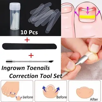 

Toenail Ingrown Correction Tool Toe Nail Lifter Nail Glue Toenail Straightening Patch Pusher Recover Pedicure Foot Care Products