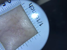 Lupa con mango de dermatoscopio 10X, visión clara suave con escala de medida, 30X, tipo B, visión más grande con luz UV