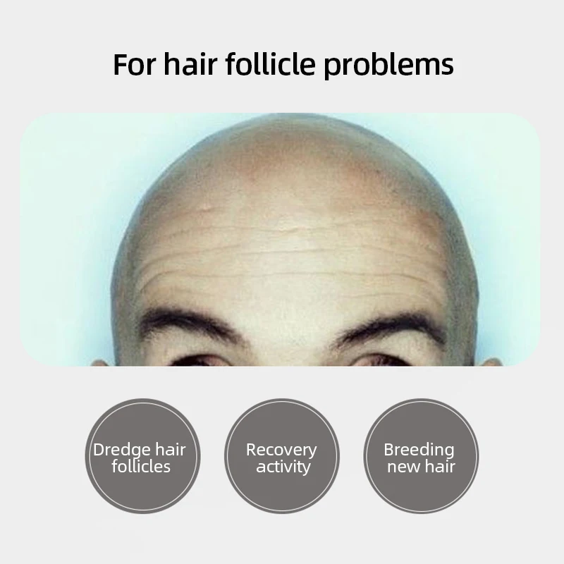 Эффективная густая жидкость для быстрого роста волос с экстрактами полигония, многоцветного цвета, сыворотка против выпадения волос