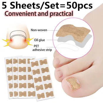 

5 Sheets/Set=50pcs Embedded Toe Nail Corrector Sticker Toenail Care Pedicure Tools Thumb Curl Correction Sticker Foot Care Tool
