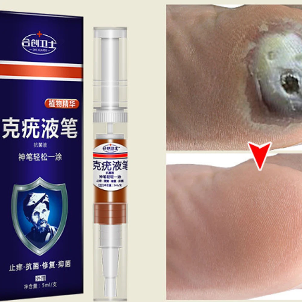 Крем для удаления мозолей ног 5 мл мазь ухода за кожей подошвенными гениталиями