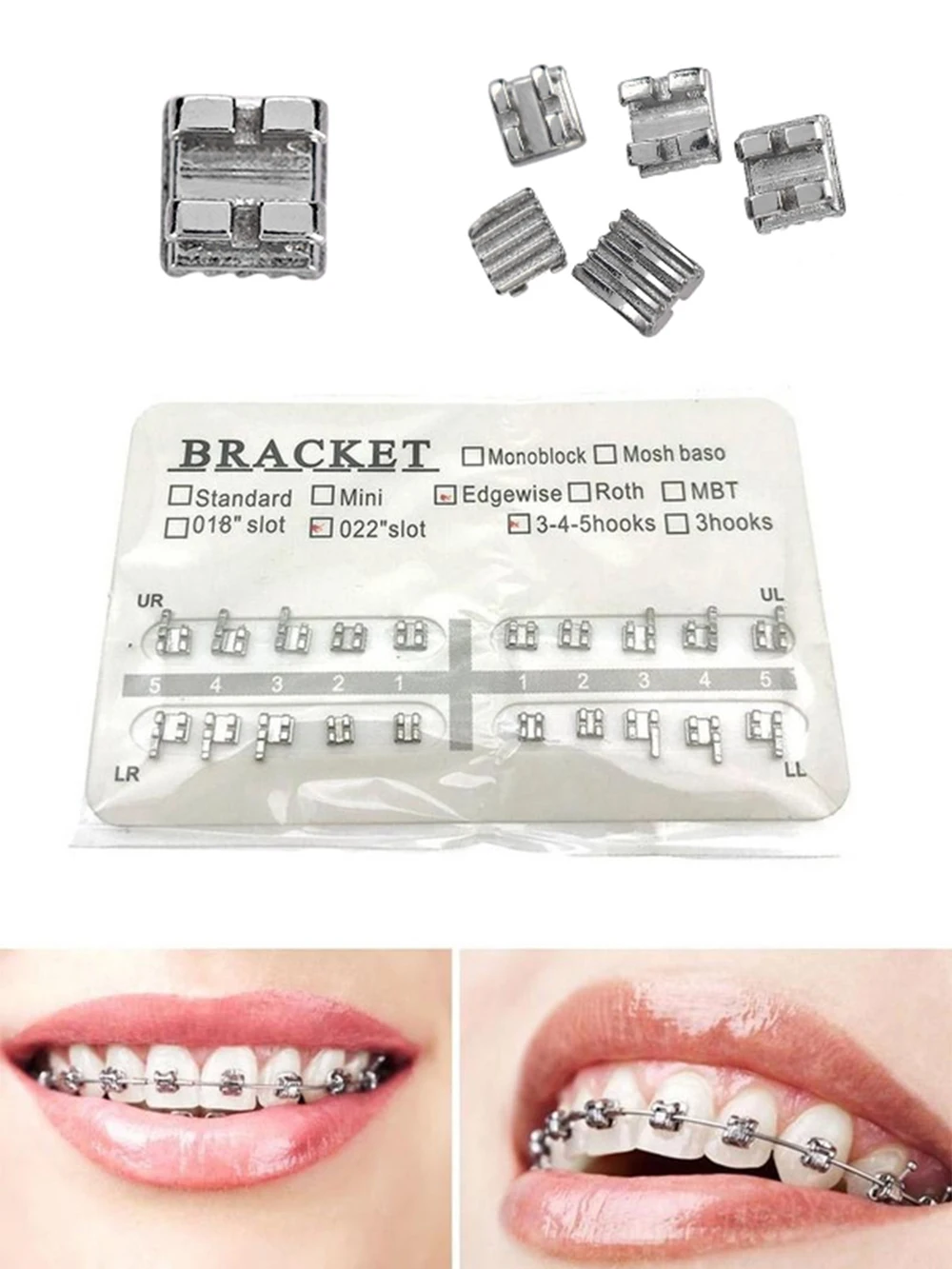 брекеты roth. Elite mini twin брекеты. брекеты mini sprint 2 brackets roth system slot 018. брекеты roth. брекеты roth.