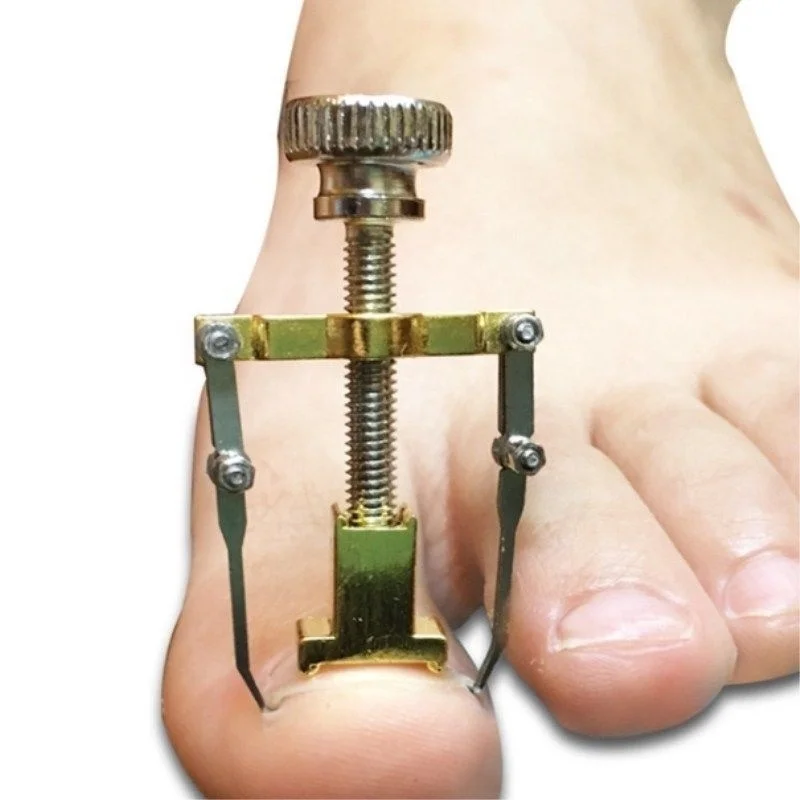 1 шт. фиксатор для коррекции вросших пальцев на носках Восстанавливающий скребок