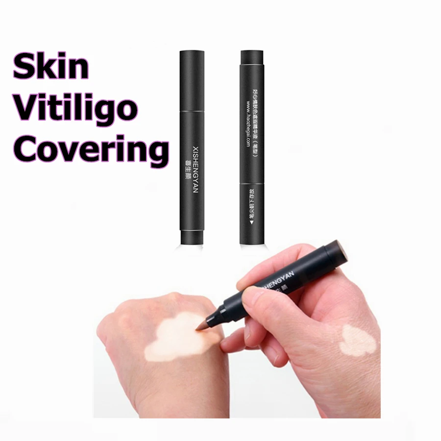 vitiligo concealer