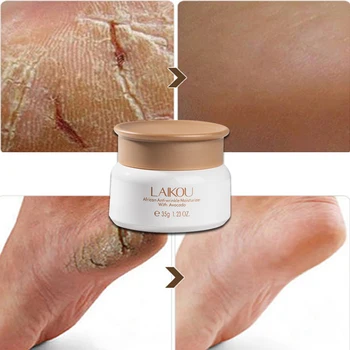 

laikou Avocado Anti-cracking Skin Care Cream face whitening cream moisturizer wrinkle remover moisturizing hydratante crema cara