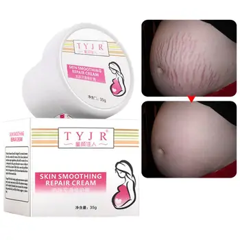 preço Gravidez Marca De Estiramento Cicatriz Remoção Maternidade Alisamento Marcas Creme Rosto Pele Creme Suave Pele Remoção Da Cicatriz Reparação R X2o2