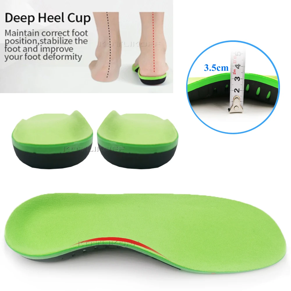 Kids Orthotics Insoles Flat Feet Shoes Sole Orthopedic O/X Type Legs Valgus/Varus Child  Arch Foot Pad Sports Shoes Inserts