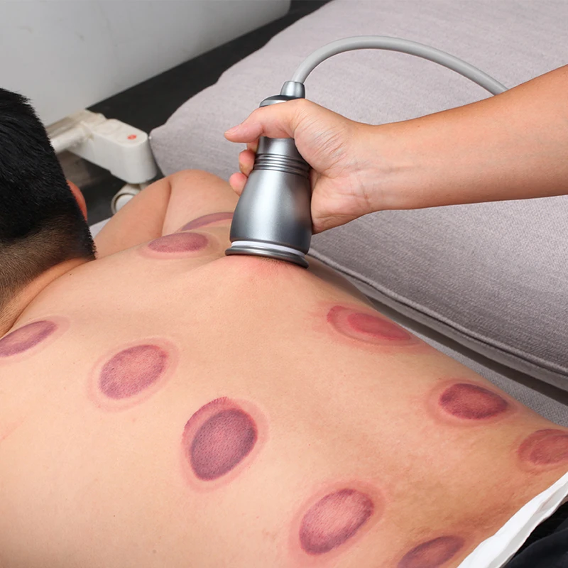 

Electric Vacuum Cupping Guasha Massage Meridian Dredge Device Promote Blood Circulation Detox Slimming Device Health Care