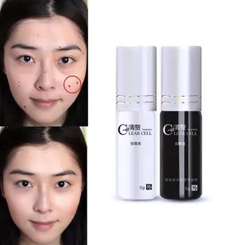 

Chinese Medication Speckle Freckle Moles Remove Water Removal Drops Speckle Tags Water Seamless Freckle Skin Cream W3G9